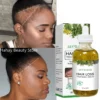Miracle Rapid Hair Growth Serum Afro Crazy Regrowth Prevent Baldness Treat Thinning Herbal Hair Growth Treatment Oil - Image 2