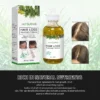 Miracle Rapid Hair Growth Serum Afro Crazy Regrowth Prevent Baldness Treat Thinning Herbal Hair Growth Treatment Oil - Image 6
