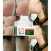 2022 Best Organic Whitening Herbal Tea Tree Oil Acne Spot Treatment Removing Anti Acne Face Cream - Image 4