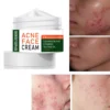 2022 Best Organic Whitening Herbal Tea Tree Oil Acne Spot Treatment Removing Anti Acne Face Cream - Image 5