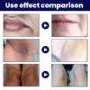 Deep-Sea Black Algae Cleaning Cream Underarm Lips Knee Sensitive Areas Bleach Exfoliating Scrub Rejuvenation Skin Care Product - Image 2