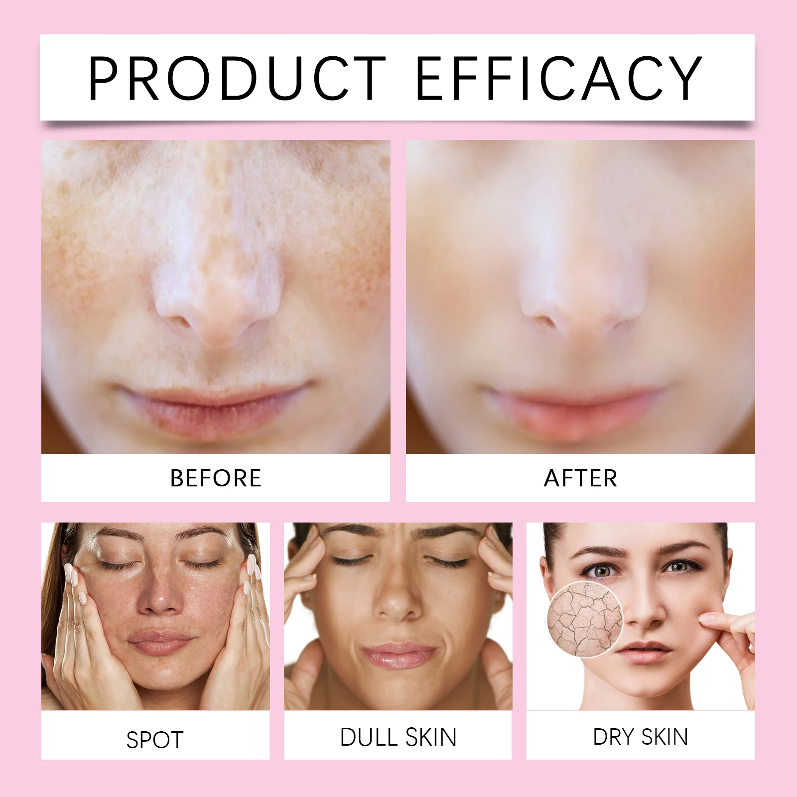 Jaysuing 50g Citric Acid Face Cream Moisturizing Nourishing Hydrating Smooth Skin Radiance For Daily Care Lightweight Formula For All Skin Types - Image 5