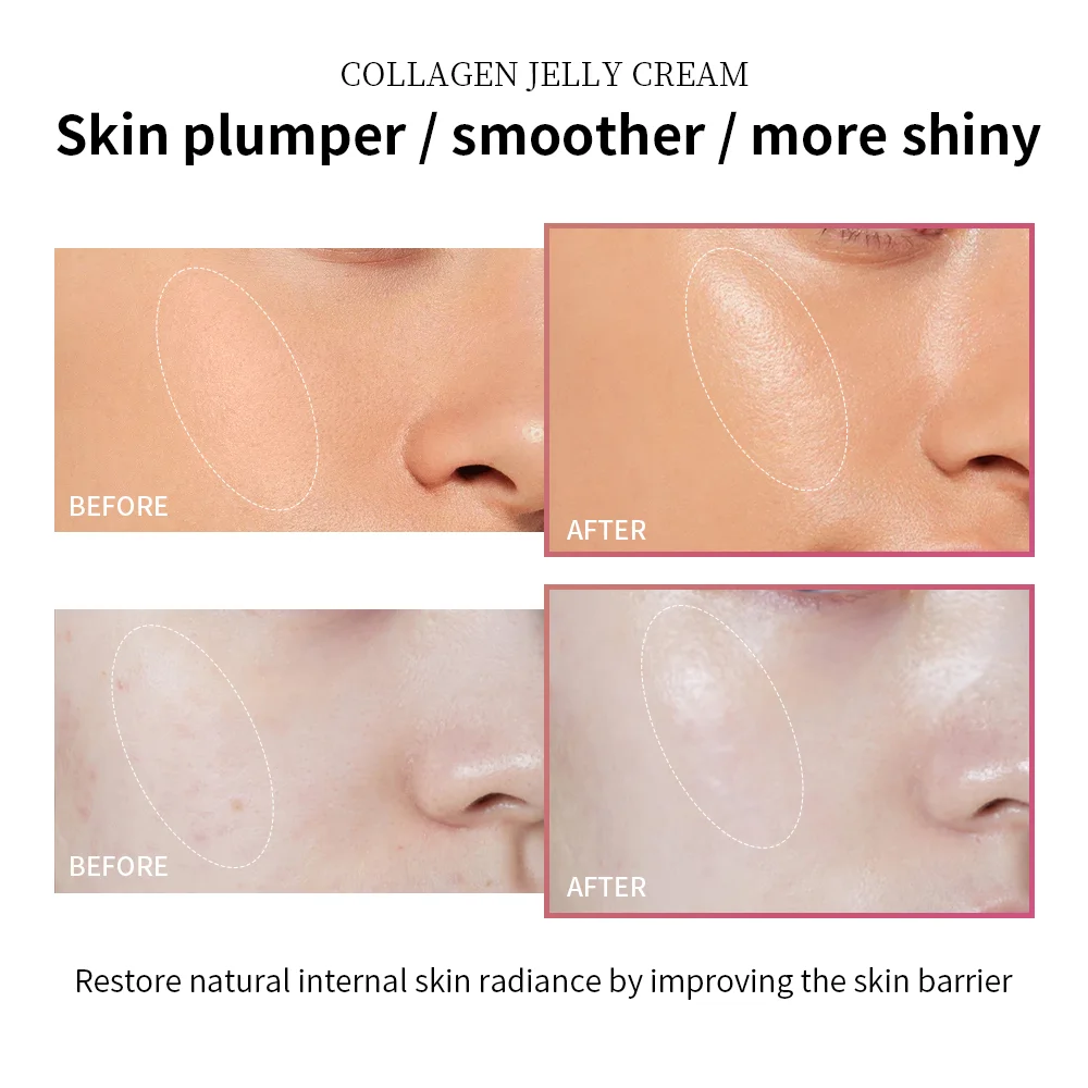 Anti Aging Collagen Face Cream 100ml Niacinamide Moisturizer Hydrating Gel For Tightening Soothing Firmness Skincare - Image 4