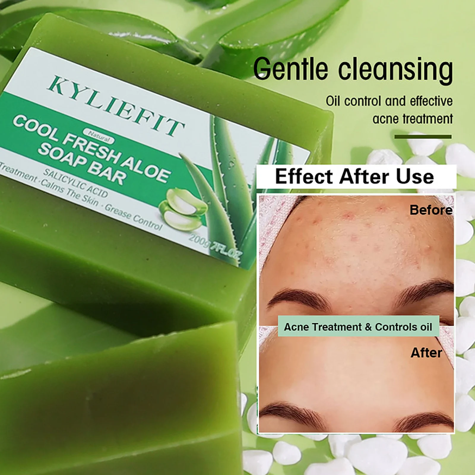 Aloe Brightening Soap Bar, Remove Dark Spots, Sun Spots, Acne, Oil Control, Clean Stains, Exfoliation, For Face and Body, 200g - Image 4