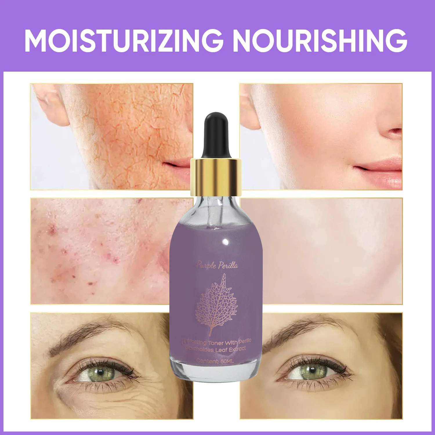 Amococo 2pcs Purple Perilla Calming Toner 60ml Each Soothing Essence for Sensitive Skin Helps Reduce Fine Lines Even Skin Tone K-Beauty - Image 8