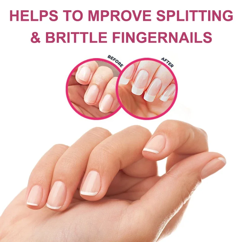 Hair, Skin & Nails Gummies | Hair Vitamins for Men and Women | Biotin SupplementsSupplements - Image 5